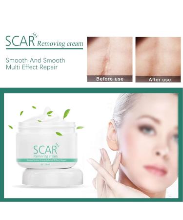 Jopwkuin Scar Removal Cream - Reduce Wrinkles & Soothe Surgery Scars - For Men - Buy Online on GoSupps.com