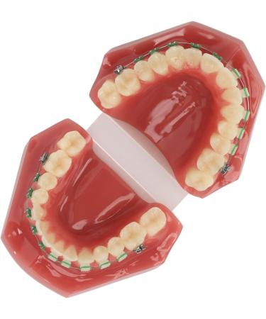 Orthodontic Bracket Model - Dental Resin Model & Portable Metal Wire for Student Learning - Buy Online on GoSupps.com