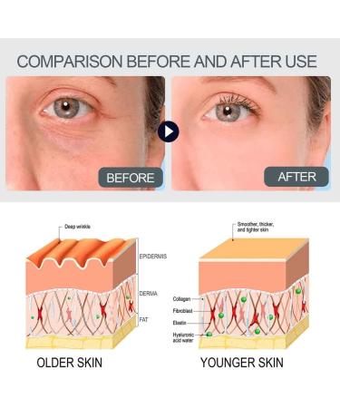  SBTRKT Voletas Collagen Boost Anti-Aging Serum Anti-Wrinkle and Brightening Skin Serum Advanced Anti-Wrinkle Serum Reduce Wrinkles Moisturizing Serum Face Serum with Vitamin C Dark Spot Corrector - Buy Online on GoSupps.com