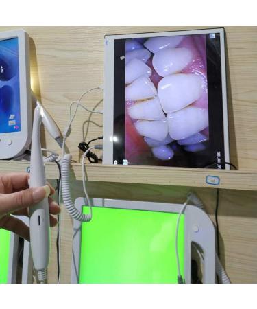 Bibee Dental Endoscopy: Personal Oral Examinations for Pets & Home Use - High-Quality Dental Exams with Large Screen Viewing - Buy Online on GoSupps.com
