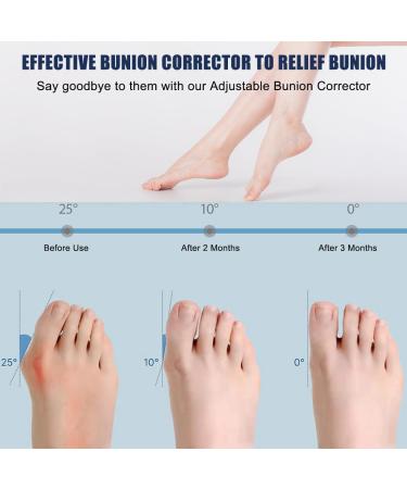 Buy Linxiu Hallux Valgus Correction Rail - Non-Slip Bunion Toe Spreader & Corrector Bandages (2 Pieces) for Day & Night Support - International Shipping Available - Buy Online on GoSupps.com