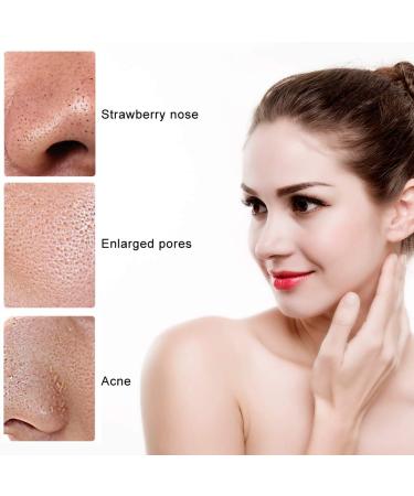 Shop Crazy Sale: 17ml Pore Cleaning Liquid & 100 Blackhead Removing Strips Effective Face Cleaning Tools - Buy Online on GoSupps.com