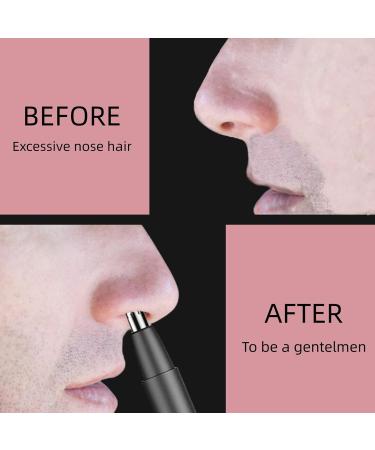Ear and Nose Hair Trimmer - 2023 Painless Rechargeable Trimmer for Men & Women | Eyebrow & Facial Hair Clippers for Easy Grooming - Buy Online on GoSupps.com
