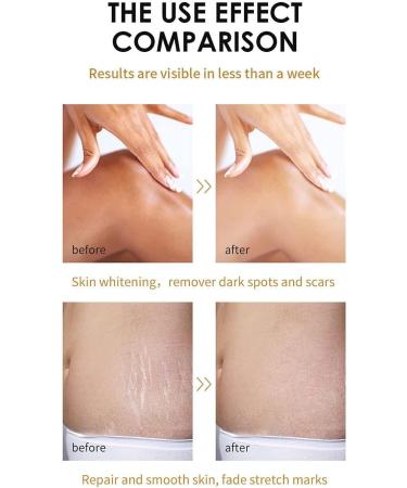 Extra Strong Yellow Peeling Oil Yellow Peeling Oil Extra Strong Peeling Oil for Dark Skin Extra Strong Peeling Oil Extra Strength Exfoliating Peeling Solution for Body Dead Skin Remover (3PC) - Buy Online on GoSupps.com