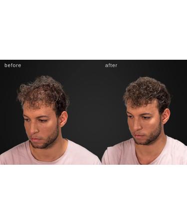 LUXE Hair Thickening Fibers - 2 Months+ Supply in Gray | Hypoallergenic & Dermatologist Tested for Confidence Boost - Buy Online on GoSupps.com