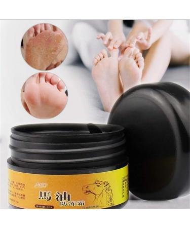 AllbestAye Foot Repair Cream - Heal Cracked Heels & Dry Feet | Moisturizing Callus Care for Soft Skin - 50g - Buy Online on GoSupps.com