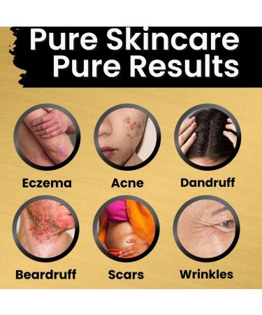 Butter By Q - All-Natural Eczema Balm | Best Cream for Eczema Rashes Atopic Dermatitis & Itch Relief - Buy Online on GoSupps.com