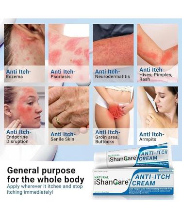 ishancare Anti Itch Soothing Cream Extra Strength Skin Itch Relief Ointment for Full Body Itching Caused by Seasonal Changes Dermatitis Eczema Rash Psoriasis Hives Bites Poison Ivy 1.76 oz 1.76 Ounce (Pack of 1) - Buy Online on GoSupps.com