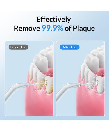 Buy M30 Dental Water Flosser - 600ML 10 Adjustable Pressure Oral Irrigator with 4 Jet Tips for Braces & Gum Care | Fast International Shipping - Buy Online on GoSupps.com