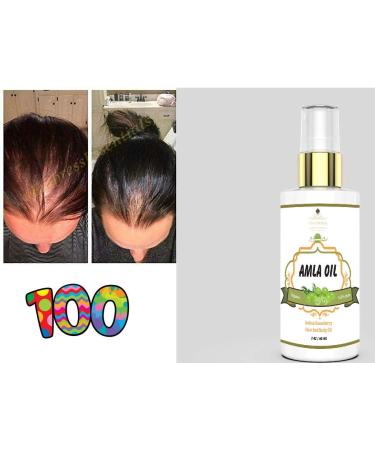 Organic Amla Oil for Hair Growth - 100% Pure Indian Gooseberry Scalp Treatment | Cold Pressed, Virgin & Unrefined Alma Oil - Revitalize & Promote Hair Growth with Therapeutic Grade Formula - Buy Online on GoSupps.com