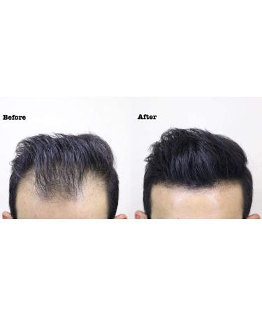 THICK FIBER Hair Building Fibers for Thinning Hair & Bald Spots (BLACK) - 25g Bottle - Instantly Conceals Hair Loss - Men & Women - 0.88oz - Buy Online on GoSupps.com