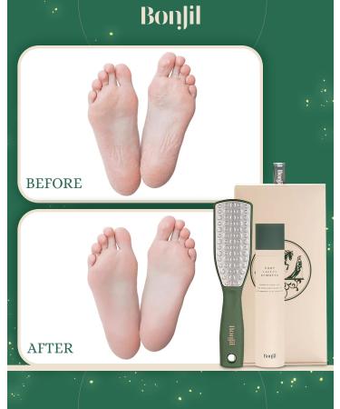 Foot Scrubber & Softening Spray | Double-Sided File Tool for Dead Skin | Doctor-Approved Cracked Heel Treatment - Buy Online on GoSupps.com