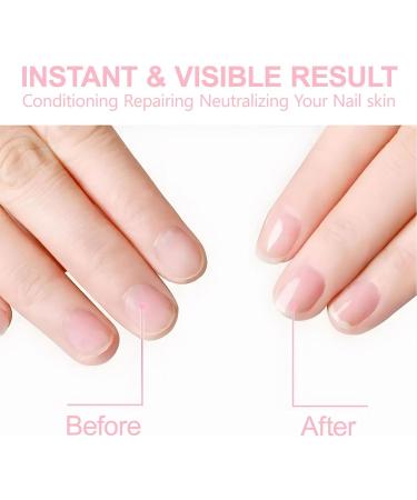 Saluaqui Nail Cuticle Care Kit Strengthens Weak Nails Trimming Tool Included Cuticle Remover Kit Safe Ingredients Easy to Use for Nourishing and Hydrating for DIY Nail LS152-2 - Buy Online on GoSupps.com