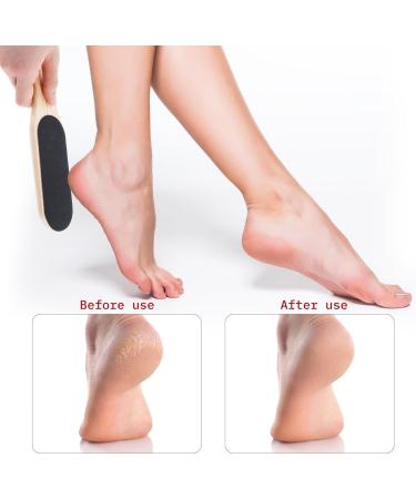 Buy Pumice Stone Foot File - Double Sided Pedicure Scrubber for Callus Removal & Soft Feet - Professional Skin Rasp Tool - Buy Online on GoSupps.com
