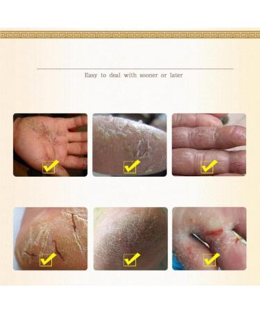 dijiusidy Horse Oil Care Cream Professional Horse Ointment Moisturizing Oil Nourishing Foot Creams Portable Heel Moisturizer - Buy Online on GoSupps.com