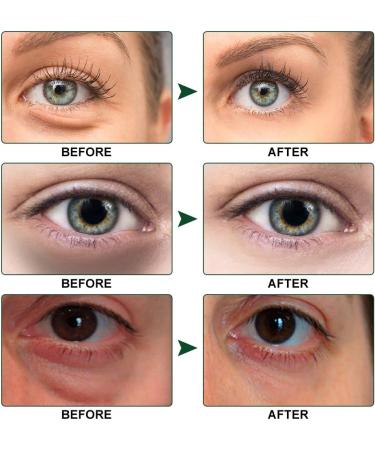 Under Eye Collagen Treatment Mask with Aloe Vera - Brighten, Reduce Wrinkles, Dark Circles, Eye Bags & Puffiness - 30 Pairs - Buy Online on GoSupps.com