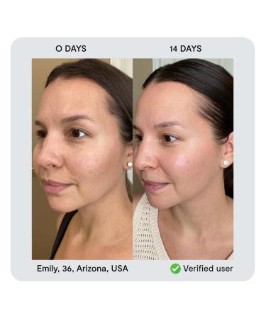 nor sken Reverse-aging Natural Vegan Facial Cream to Increase Skin Elasticity and Collagen Decrease Wrinkles and Redness - Buy Online on GoSupps.com