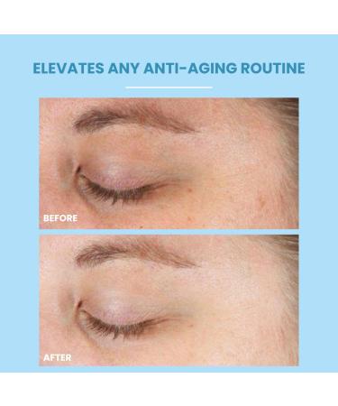 Retinol Boost Rejuvenate Serum  - 1 % Cold Processed Vitamin A Night Treatment with Polyphenols Aloe & Green Tea Anti Aging Acne Control & Firming Face Serum 1 fl oz - Buy Online on GoSupps.com