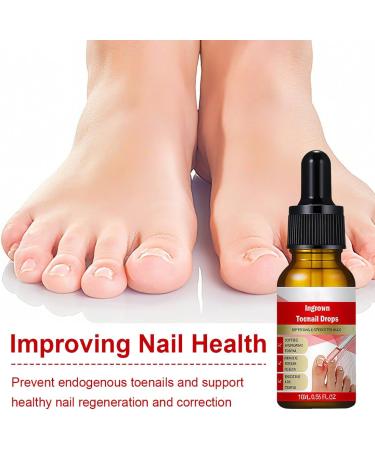 XPEX 30ml Mycose Ongles Des Pieds Strengthens and Revitalizes Nails pour Nails Damaged by Mycosis or Light Trauma pour D color s Endommag s et pais - Buy Online on GoSupps.com