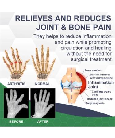 BIOMAGAR Bee Venom Pain and Bone Healing Cream New Zealand Bee Venom Cream Joint and Bone Therapeutic Cream for Arm Waist Back  - Buy Online on GoSupps.com