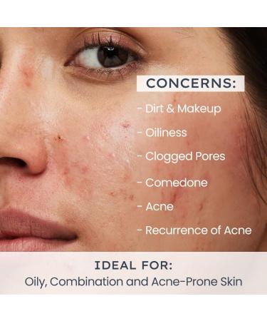 Oil Control Face Wash for Oily Skin & Acne | Deep Cleanser for Men & Women | 100ml - Reduces Oil & Dirt - Buy Online on GoSupps.com