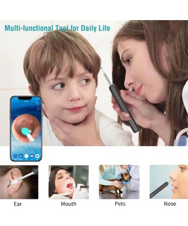 Otoscope Endoscope Ear Spoon Ear Wax Cleaner Ear Wax Removal Kit USB 1080p Hd Load Otoscope Wi-Fi Visible Ear Wax Removal Tool Dia 3.6mm Ear Cleaner with Camera For iOS android (White) - Buy Online on GoSupps.com