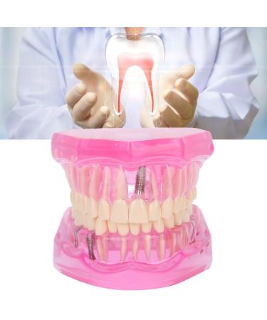 Transparent Adult Teeth Model - Pathological Removable Dental Teaching Tool Standard Size - Ideal for Study & Repairs - Buy Online on GoSupps.com