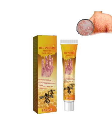 Youth Bee Venom Psoriasis Treatment Cream New Zealand Bee Venom Professional Psoriasis Treatment Cream Soothing and Moisturizing Psoriasis Treatment Cream for All Skin Types (1pcs)