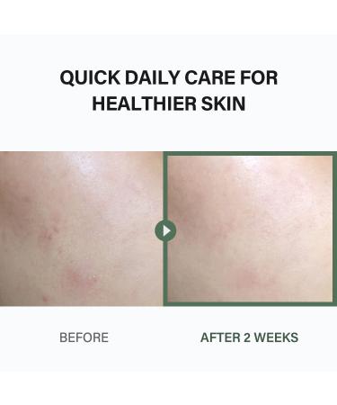 Celimax Ji.Woo.Gae Heartleaf BHA Peeling Pad - 60pads | Gentle Facial Exfoliating Toner for Smooth & Effective Results - Buy Online on GoSupps.com