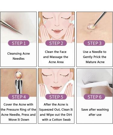 Blackhead and Pimple Popper Kit - Stainless Steel Acne Extraction Tool Set for Blackhead, Whitehead, and Spot Removal - Buy Online on GoSupps.com