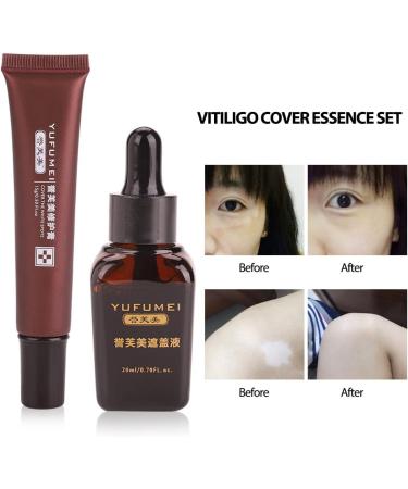Vitiligo Concealer Repair Cream | Professional Scar Coverage Spot Treatment | Waterproof Natural Extract Formula - Buy Online on GoSupps.com