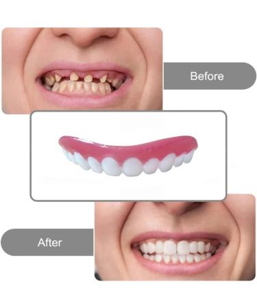4PCS Natural Shade Denture Teeth Veneer Set for Upper and Lower Jaw - Perfect Solution for Imperfect Teeth, Braces, and Confident Smile - Men and Women - Buy Online on GoSupps.com
