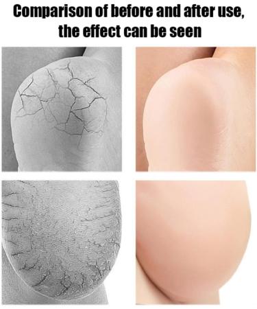 Wambere 3 Pairs Gel Heel Socks Silicone Moisturising Socks Open Toe Socks Spa Socks Foot Care Socks Foot Protectors for Dry Cracked Heels Suitable for All Day Skin Colour Skin-coloured - Buy Online on GoSupps.com