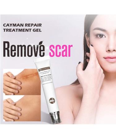 Scar Removal Cream for Face & Body - Skin Remover for Scars & Marks (White, One Size) - Buy Online on GoSupps.com