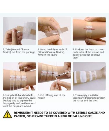Smerphox Wound Closure Strip - Sterile First Aid Band Kit for Emergency Wound Care - Suture-Free Adhesive Stitch Device - 6pcs - Buy Online on GoSupps.com