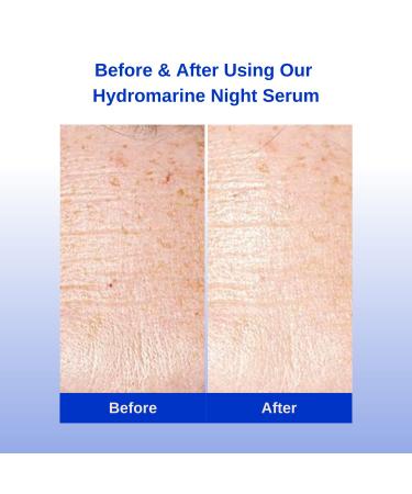 Michael Marcus Hydromarine Night Serum - Anti-Wrinkle & Skin Brightening for All Skin Types | Bakuchiol Niacinamide Peptides & Algae (30ml - Buy Online on GoSupps.com