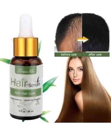 Natural Hair Growth Serum - Anti-Hair Loss & Thickening | Herbal Essence for Thinner Hair (30 ml) - Buy Online on GoSupps.com