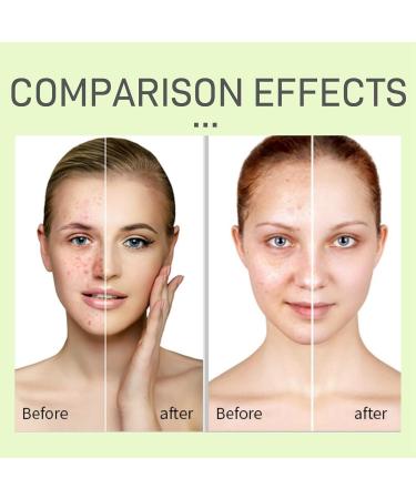 Centella Asiatica Face Serum for Women Centella Asiatica Extract Facial Serum Centella Serum for Calming Soothing Skincare Moisturiser Hydrating Serum Centella Moisturiser Brightening Serum 100ml - Buy Online on GoSupps.com