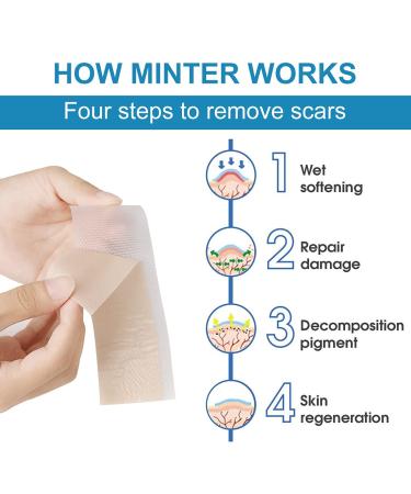 MT Healthy Silicone Scar Removal Sheets - 6 Pcs (5.9 x 1.6 inches) - 3 Months Supply - Reusable & Washable - Comfortable & Painless - For Hypertrophic Scars and Keloids - Buy Online on GoSupps.com