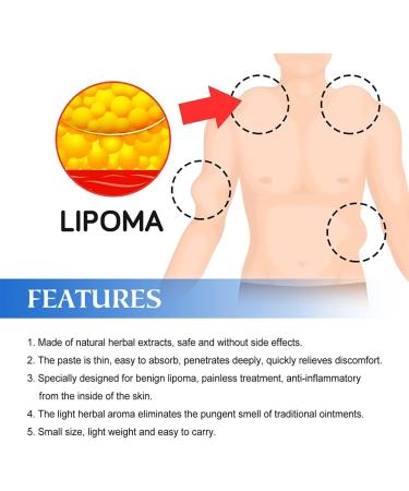 LUFFREE Lipom Distance Cream - Natural Ointment to Remove Lipomas | 3 Piece Set - Buy Online on GoSupps.com
