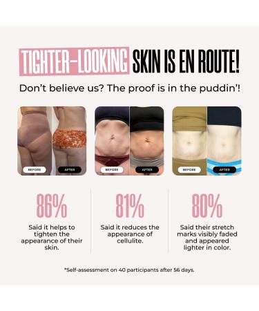 MA LYS RE-LURE Tight & Tone Body Serum | Hyaluronic Acid Skin Tightening & Hydrating Serum for Women - Achieve a Toned Look - Buy Online on GoSupps.com