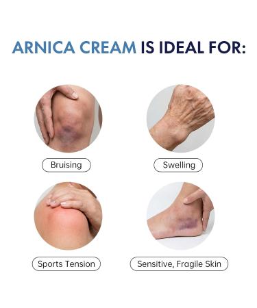 Arnica Bruise Cream Extra Strength for Bruising Swelling & Muscle Discomfort Enriched with Arnica Montana & Vitamins K C & E Plus 9 Plant Compounds Fast Acting Thin Skin Long Lasting 4 Oz - Buy Online on GoSupps.com