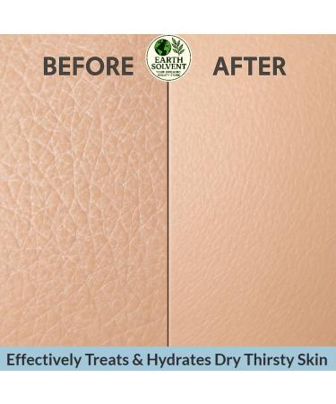 Earth Solvent Body Butter for Men & Women 8 Fl Oz Hydrating Cream with Shea Butter and Vitamin E All Skin Types Aromatherapy Cruelty Free (Watermelon) - Buy Online on GoSupps.com