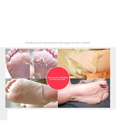 Foot Peeling Mask - Effective Treatment for Cracked Heels Dry Skin & Calluses | 1 Pair for Smooth Soft Feet - Buy Online on GoSupps.com