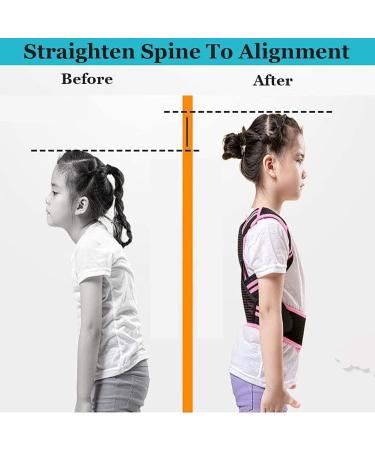 Posture Corrector for Kids and Teens Adjustable Upper Back Brace Posture Corrector with Soft Shoulder Pads and Elastic Belts Hunchback Corrector for Improve Slouching and Humpback Pink X-Small - Buy Online on GoSupps.com