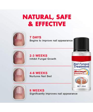 Extra Strong Fungal Nail Treatment 20ml - Premium Toenail and Fingernail Fungus Eliminator - Anti-Fungal Repair and Strengthening - 1 PCS - Buy Online on GoSupps.com