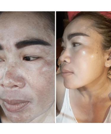 Detangling Facial Cream with Tranexamic Acid & Thanaka - Hydrate & Brighten Your Skin | International Shipping Available - Buy Online on GoSupps.com