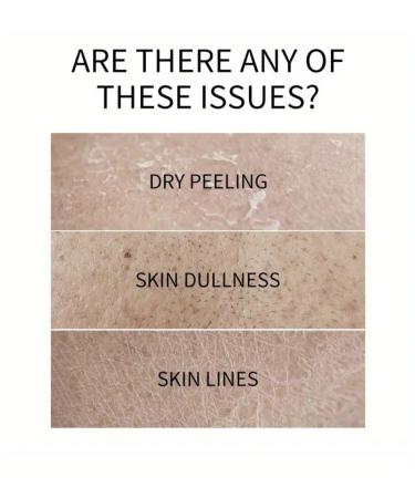 Turmeric Body Lotion with Vitamin C - Nourishing 3 Fl Oz Moisturizer for Glowing Skin | International Shipping Available - Buy Online on GoSupps.com