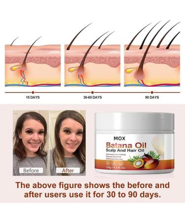 Batana Oil Batana Oil for Hair Growth Dr Sebi Botana Oil Raw Batana Oil Batana Oil Organic Banana Oil for Hair Growth Batana Oil Spoild Batana Oil - Buy Online on GoSupps.com