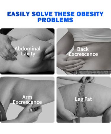 AICHUN BEAUTY Slimming Body Essential Oil Capsules - Anti-Cellulite Fat Burning 400mg (90 pcs) - International Shipping Available - Buy Online on GoSupps.com